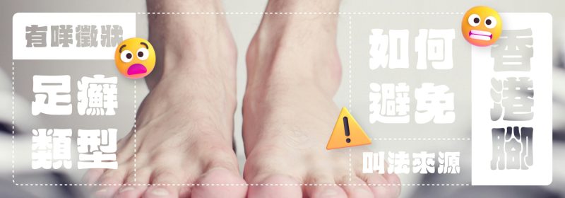香港腳 | 有咩徵狀？推薦遠離香港腳7個方法